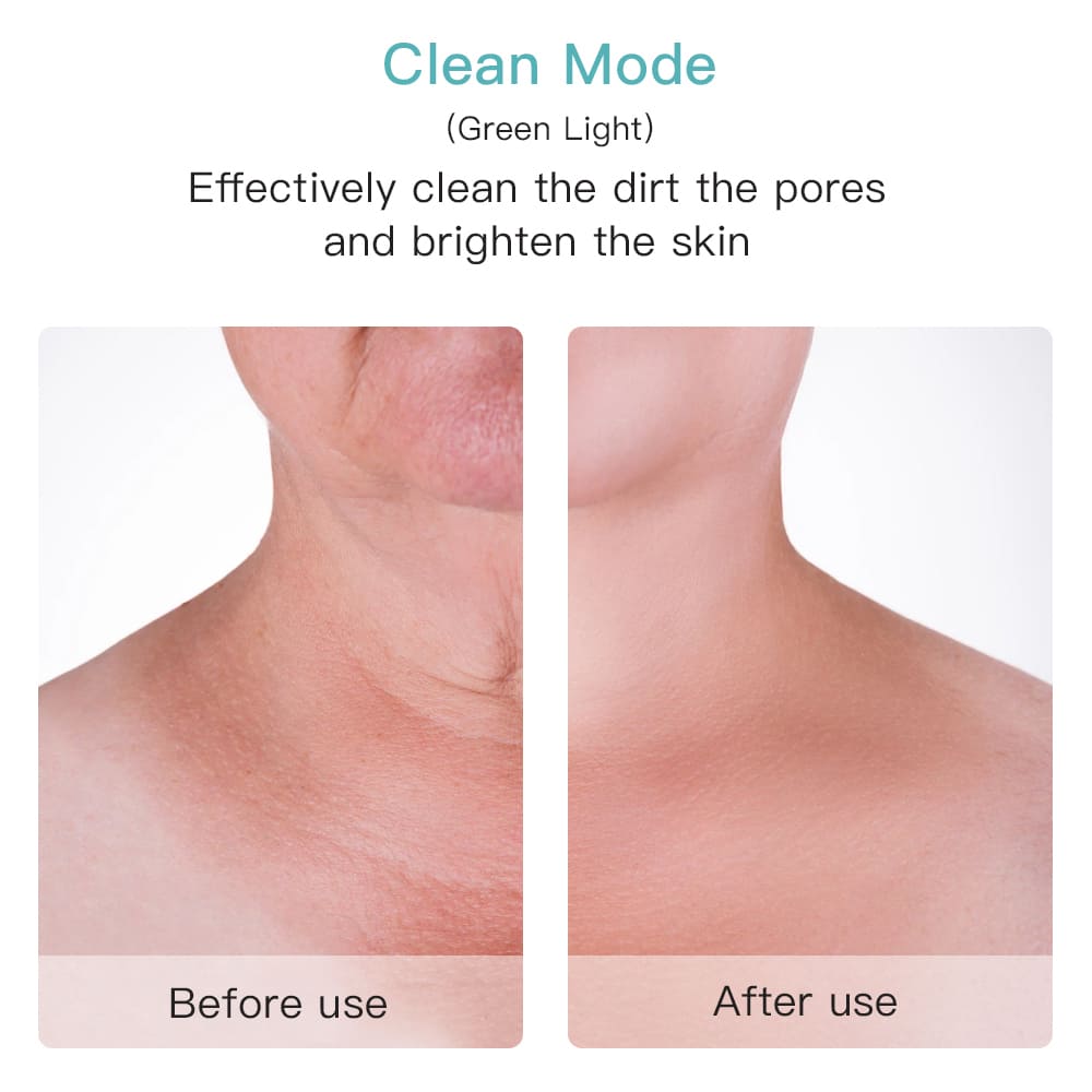 Efikasno sredstvo za čišćenje pora na licu ili vratu prije poslije